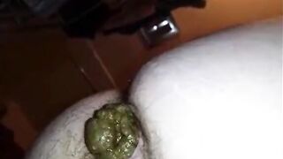 Hairy butt woman shitting a big quantity closeup
