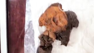 Massive release of thick poop