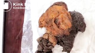 Massive release of thick poop