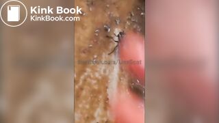 Behind the scenes with maggots