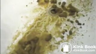Woman shitting liquid after enema