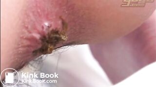 Real Fart asshole movement closely