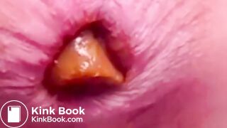 Constipated Hard Poop Fun