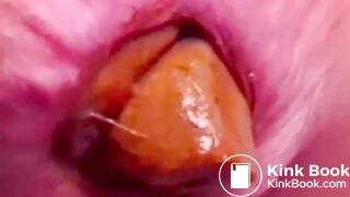 Constipated Hard Poop Fun