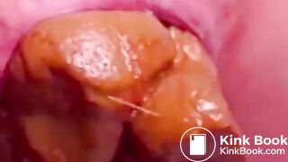 Constipated Hard Poop Fun