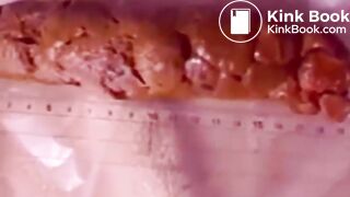 Constipated Hard Poop Fun