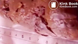 Constipated Hard Poop Fun