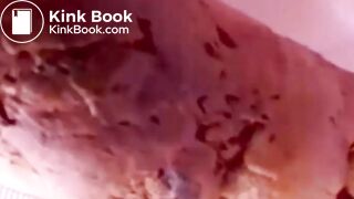 Constipated Hard Poop Fun