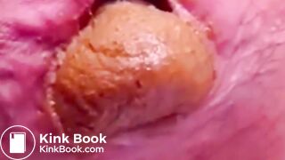 Constipated Hard Poop Fun