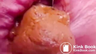 Constipated Hard Poop Fun