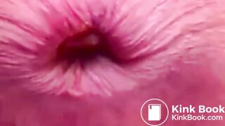 Constipated Hard Poop Fun