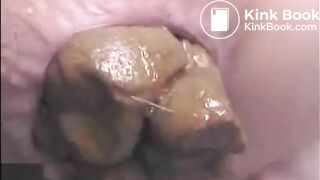 This woman is shitting a huge turd closeup