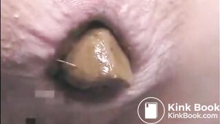 This woman is shitting a huge turd closeup