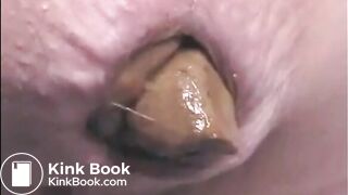 This woman is shitting a huge turd closeup