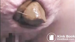 This woman is shitting a huge turd closeup