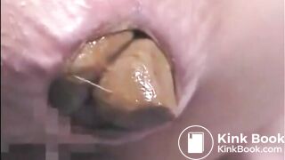 This woman is shitting a huge turd closeup