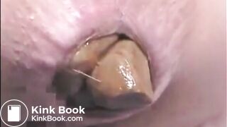 This woman is shitting a huge turd closeup