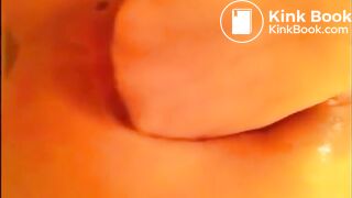 Anal self fisting prolapsed with little shit