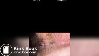 Gotta wipe that hole