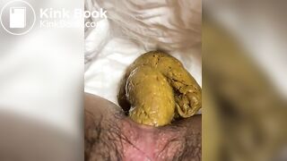 Me shitting on diaper