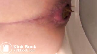 Another huge poop (June 2018)