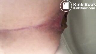 Toilet poop (Febuary 2019)