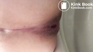 Toilet poop (Febuary 2019)