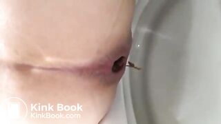 Normal day poop (May 2018)