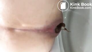 Normal day poop (May 2018)