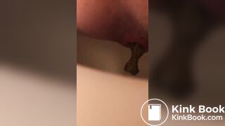 Hard poop