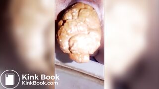 rectum à vider