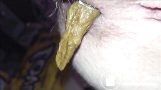 Hairy butthole woman shitting closeup