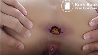 Me shitting