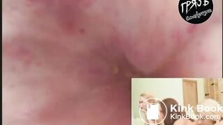 camera in the butthole