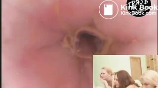 camera in the butthole