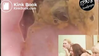 camera in the butthole