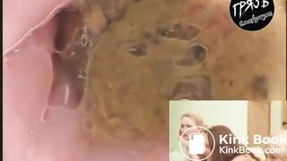 camera in the butthole