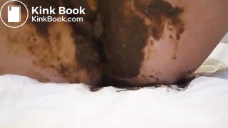 No Wonder She Has Hemorrhoids