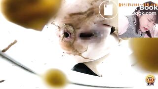 The brown side of life 1184