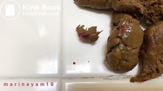 I shit out a butt plug