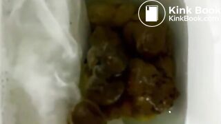 Stubborn and Stuck Poop