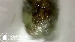 Stubborn and Stuck Poop