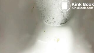 Stubborn and Stuck Poop