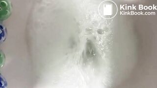 Stubborn and Stuck Poop