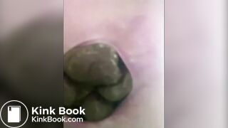 Stubborn and Stuck Poop