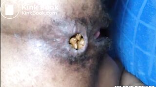 Hairy asshole ebony shitting closeup