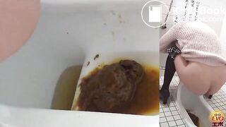 The brown side of life 1156