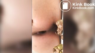 redbone dookie nuggets