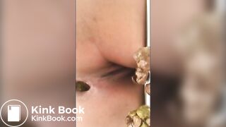 redbone dookie nuggets