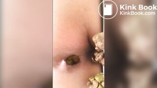 redbone dookie nuggets